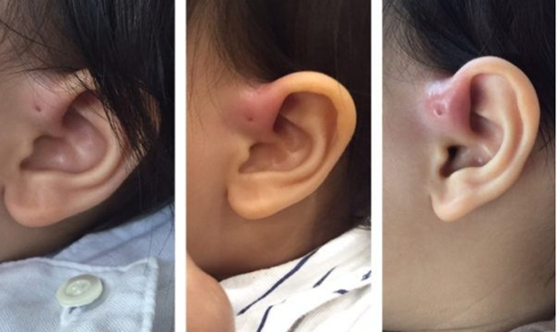 DÒ LUÂN NHĨ BẨM SINH