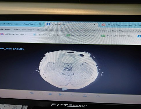 KHOA GÂY MÊ HỒI SỨC “ CÁNH TAY ĐẮC LỰC ĐỒNG HÀNH CÙNG CÁC CHUYÊN KHOA” KHOA NGOẠI THẦN KINH- NIỀM TIN VÌ NGÀY MAI TỐT ĐẸP!