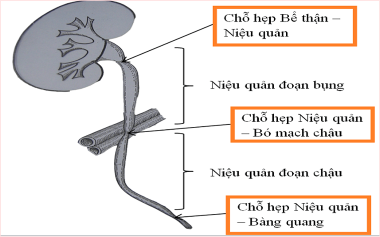 Chăm sóc bệnh nhân sau tán sỏi niệu quản những điều bạn nên biết